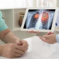 Understanding Lung Cancer Treatment: What You Need to Know