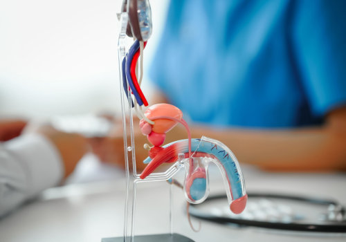 Understanding Prostate Cancer Treatment: A Comprehensive Guide