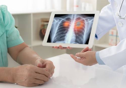 Understanding Lung Cancer Treatment: What You Need to Know